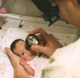 Come si effettua la visita oculista nel neonato? Guarda il video