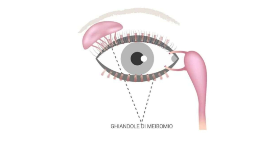 Calazio nei bambini: quando l’infiammazione dell’occhio può segnalare un problema alimentare